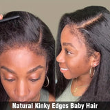 Perruque frontale en cheveux humains Kinky Skin Melt 360 Lace 4C Edge avec sangle invisible ajustable